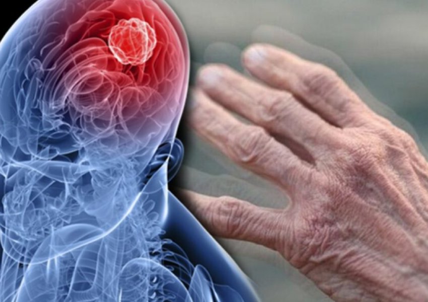 Parkinson, një sëmundje që vjen nga uji? Zbulimet e reja që sfidojnë shkencën