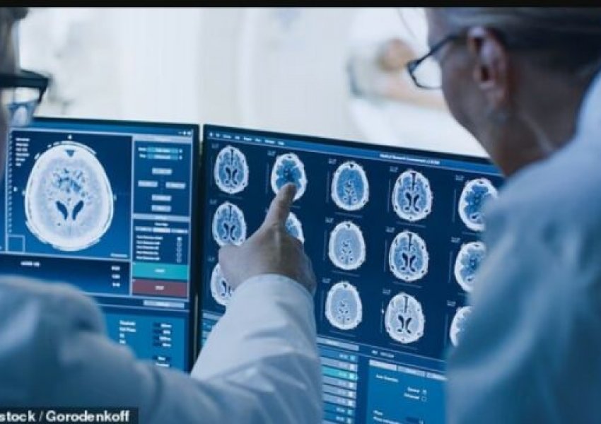 Shkencëtarët identifikojnë katër zakone të thjeshta që mund ta 'rinovojnë' trurin deri në tetë vjet