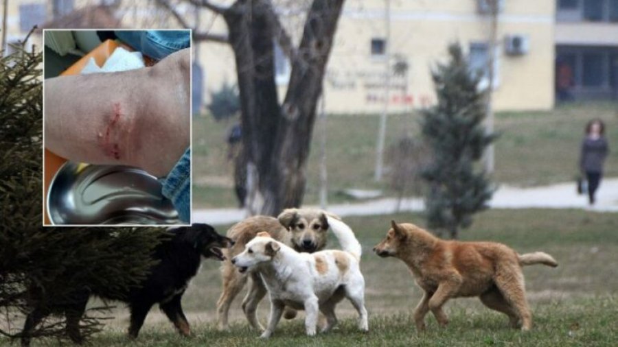 Qentë endacakë bëjnë kërdinë në Klos, 5 persona përfundojnë në spital