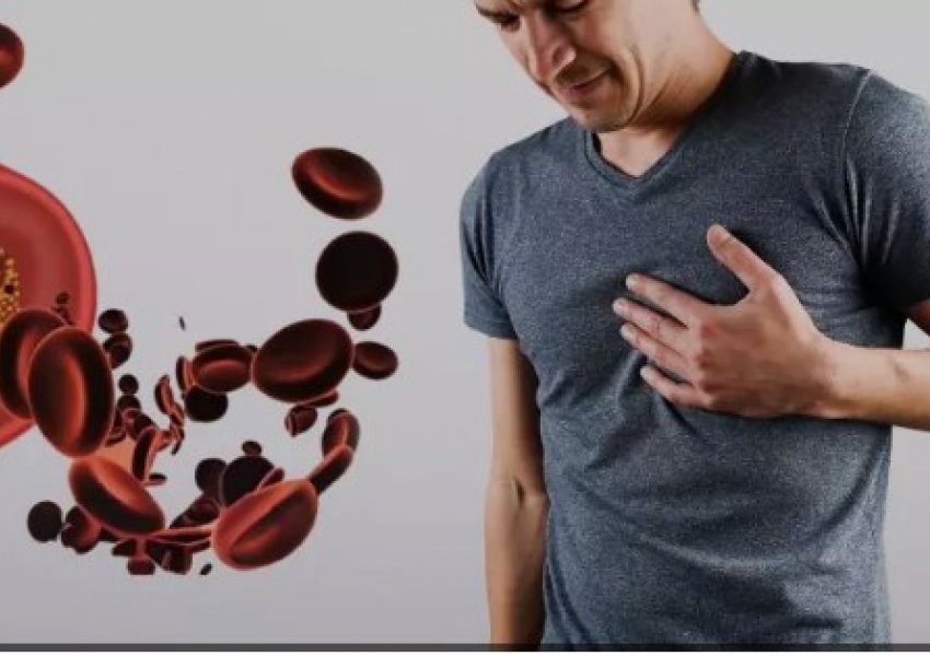 Mosha e duhur kur duhet të nisë matja e kolesterolit