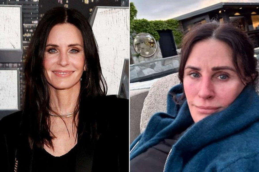 Courteney Cox shfaqet pa grim dhe rrëfen luftën me problemet e lëkurës
