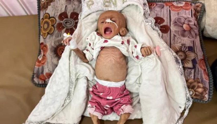 Situatë dramatike dhe krizë humanitare në Gaza, qytetarët përballen me mungesë ushqimi, medikamentesh dhe uji