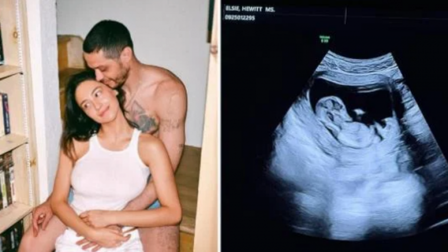 Së shpejti prindër! Pete Davidson dhe Elsie Hewitt në pritje të fëmijës së parë 