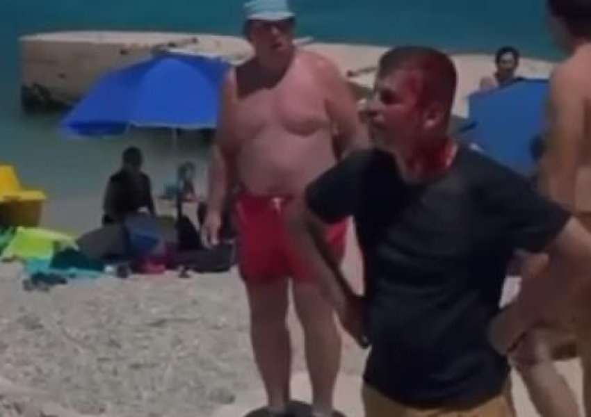 Dy pronarë hotelesh rrihen për çadrat e plazhit! Video e sherrit në plazhin e Ksamilit 