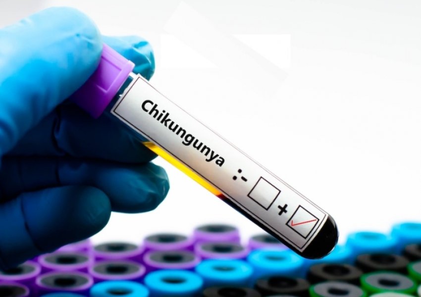 Chikungunya, alarm në Europë/ Epidemi në Francë dhe rast i parë i konfirmuar në Itali, OBSH paralajmëron rrezik global
