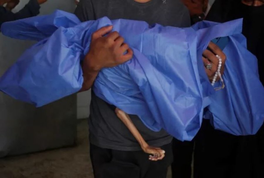 Dhjetra fëmijë të vdekur nga mungesa e ushqimit, Gaza ka nevojë për 250,000 kanaçe formulë për foshnje në muaj