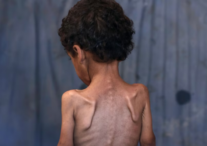 Ekspertët e krizave ushqimore: Skenari më i keq i urisë po ndodh në Gaza