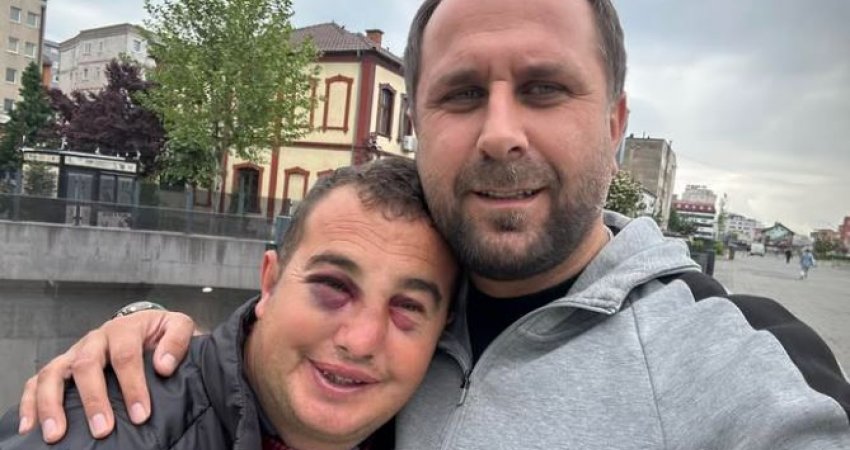 Sulmohet një person me aftësi të kufizuara në Ferizaj