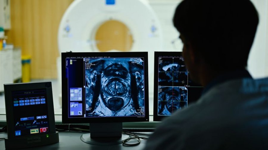 Shkencëtarët bëjnë një zbulim 'të papritur' për trajtimin e kancerit