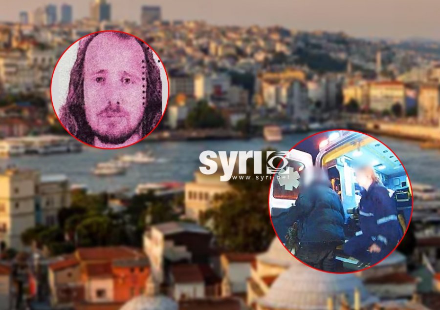 Bëri transplant të flokëve dhe trajtim dentar, humb jetën 36-vjeçari shqiptar në Turqi