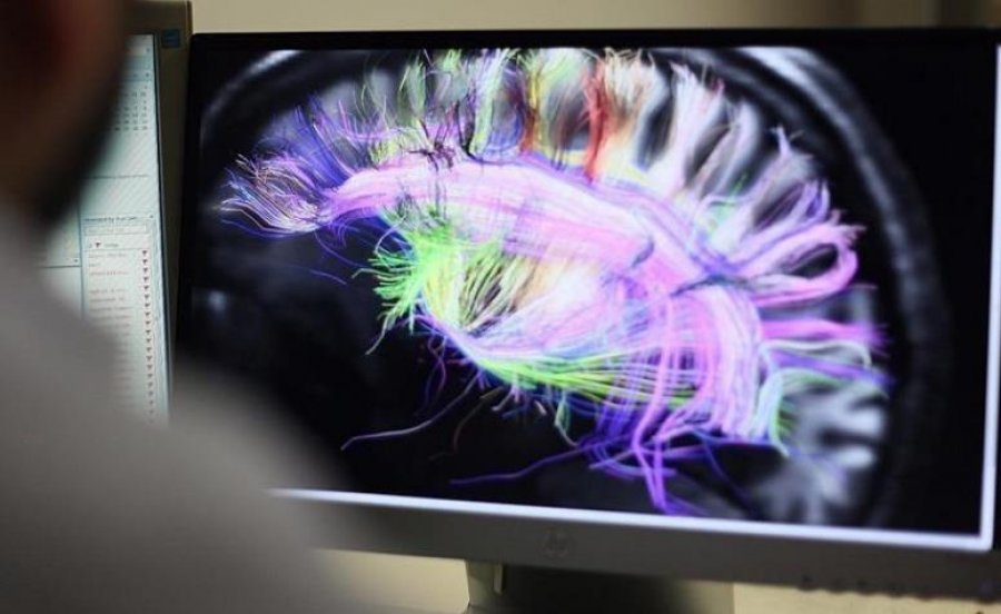 OBSH: Shumica e vendeve nuk kanë politika për të trajtuar çrregullimet neurologjike