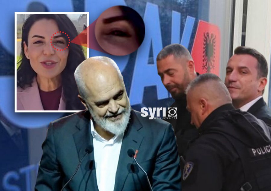 Për pushtetin e Ramës sot ishte dita e ‘syve të nxirë’