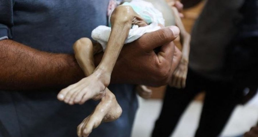 Rëndohet bilanci/ Shkon në 441 numri i viktimave nga uria në Gaza