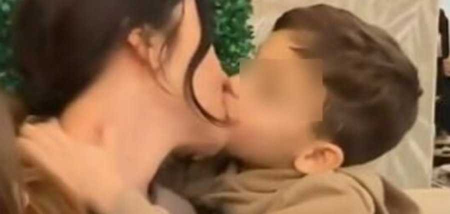 Pediatrët italianë paralajmërojnë për puthjet në buzë me fëmijët: Rreziqe infektive dhe psikologjike