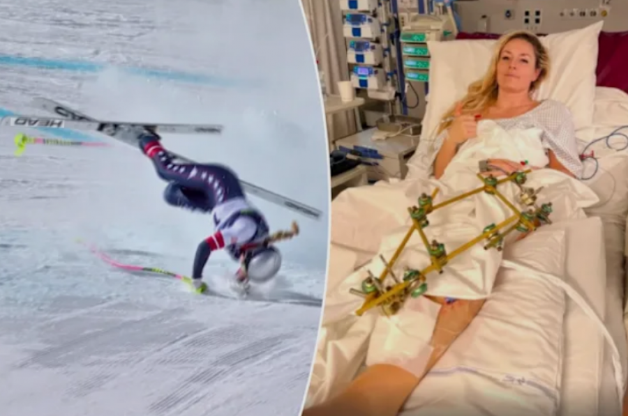 Milano Cortina 2026/ Lindsey Vonn del nga spitali dhe kthehet në SHBA