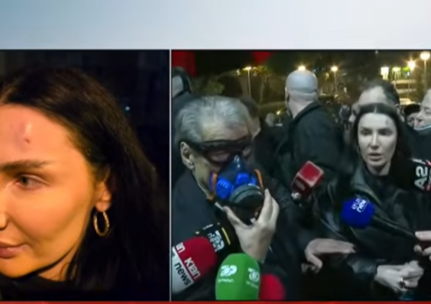 U godit me plumb gome nga Policia/ Ish-kandidatja për deputete tregon momentet e tmerrit: S’u ndjeva mirë dhe...