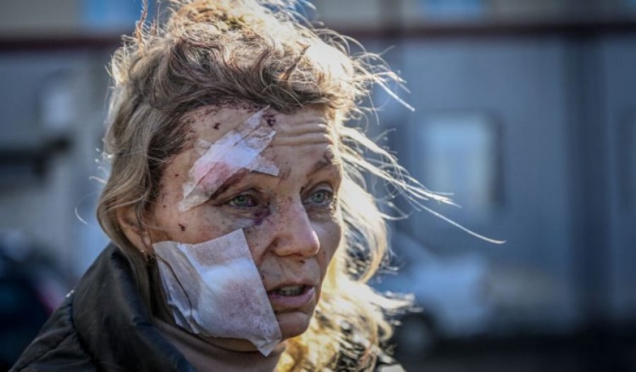 'Fytyra e parë e luftës'/ 52-vjeçarja ukrainase kthehet në atdhe pas rehabilitimit dhe sfidon Putin: Dua ta takoj