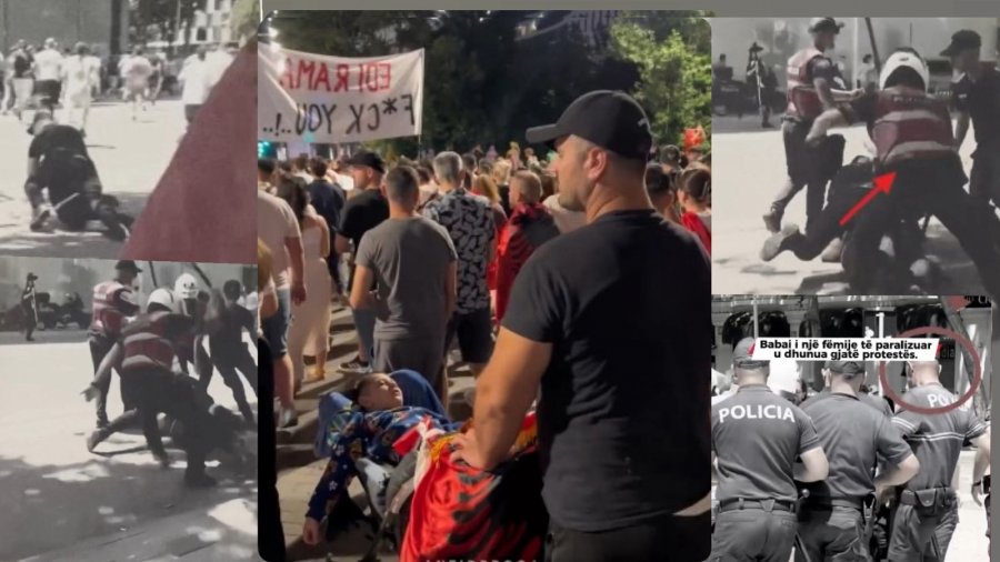 U dhunua nga policia/ Drama e protestuesit të arrestuar: Në shtëpi e pret djali me epilepsi, shteti nuk...