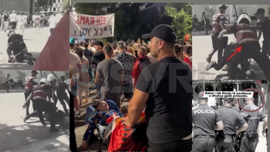 video-policia-e-rames-rreh-brutalisht-babain-e-femijes-se-paralizuar-e-godet-me-shqelma-e-shkop-gome