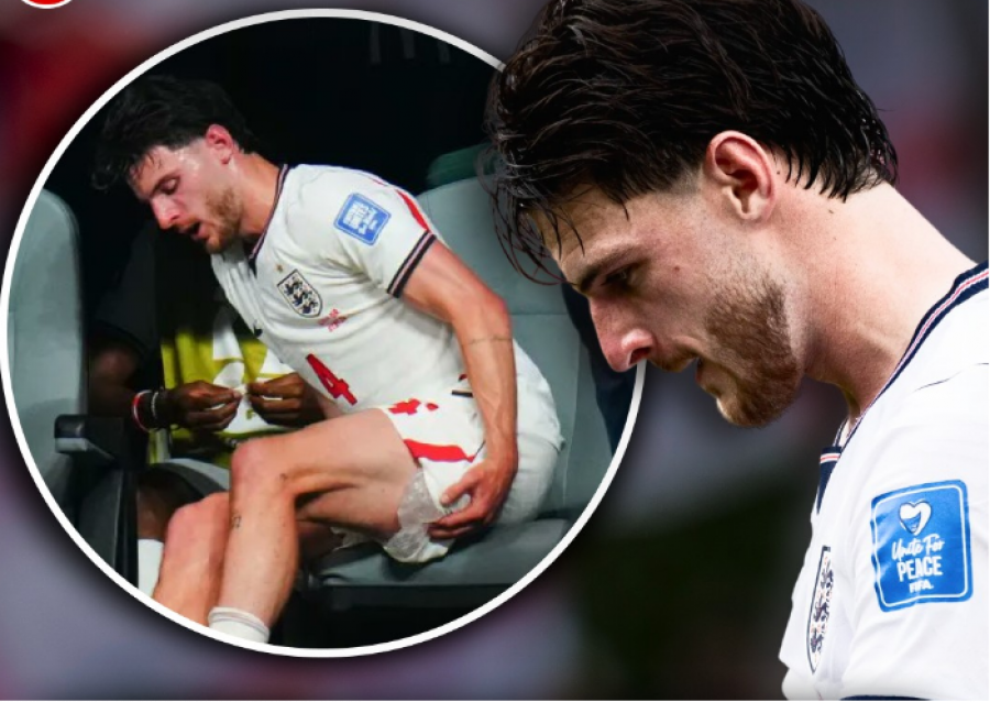 Anglia në alarm, Tuchel shqetësohet: Declan Rice rrezikon të mungojë ndaj Norvegjisë