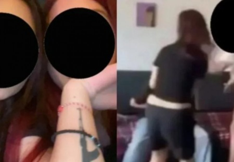  Sy të nxirë  flokë të shkulur   Babai i 17 vjeçares së dhunuar në Fier  Policia as mori masa  mjekët i bënë një serum dhe 