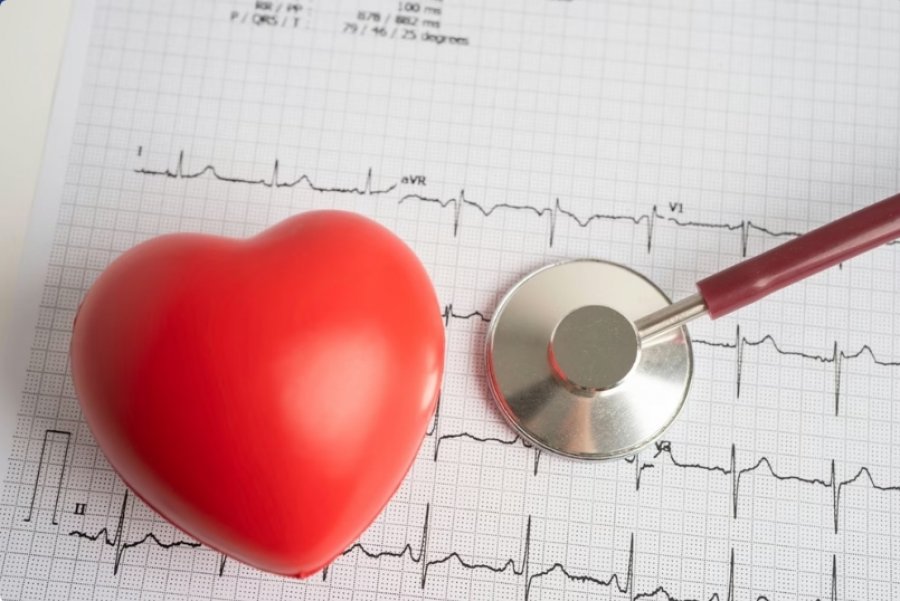Si të përgatiteni për një EKG dhe çfarë mund të tregojë ajo