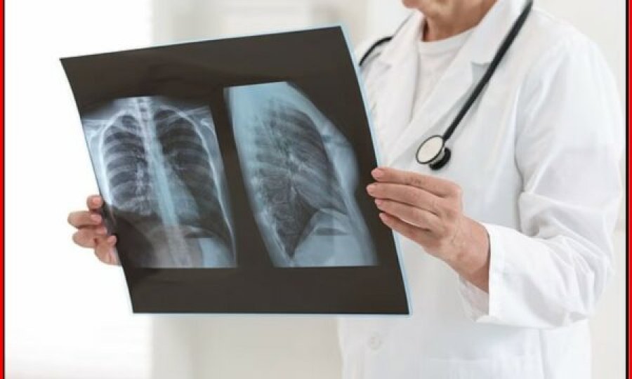 Infeksionet e rënda të frymëmarrjes mund të rrisin rrezikun e kancerit në mushkëri