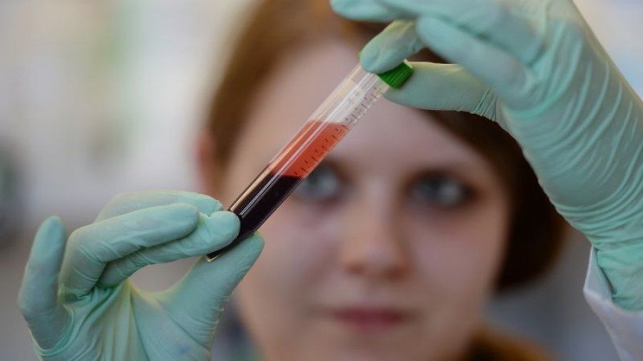 Studimi: Testi i ri gjakut që zbulon tumoret e trurit dhe i monitoron ato në kohë reale