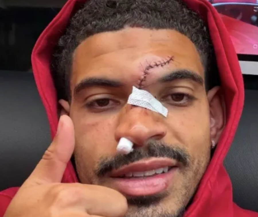 Përplasje e frikshme kokë më kokë, Morgan Gibbs-White dhe Robert Sánchez përfundojnë si 'scareface