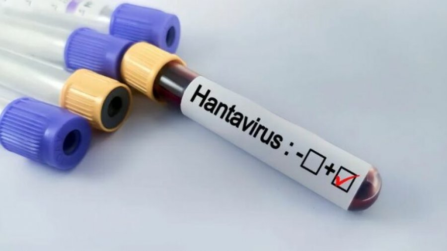 Hantavirus në anijen turistike/ A do të kemi një pandemi të re? Çfarë dihet për virusin që përhapet nga brejtësit