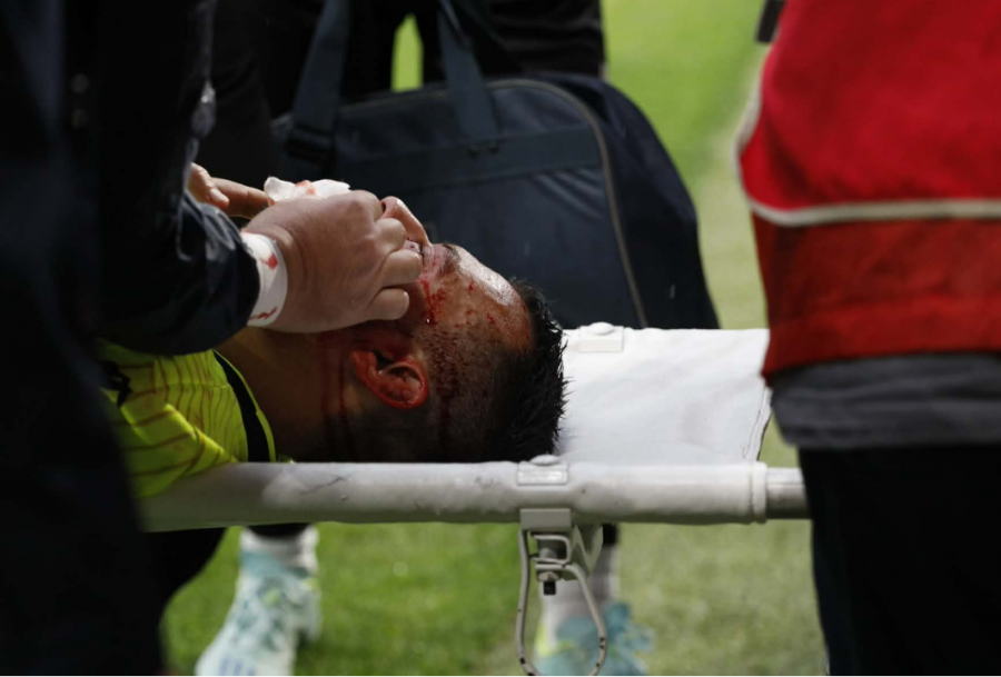 VIDEO/ Frikë në finalen e Kupës, portieri Teqja dëmtohet rëndë nga Bakayoko i Egnatias