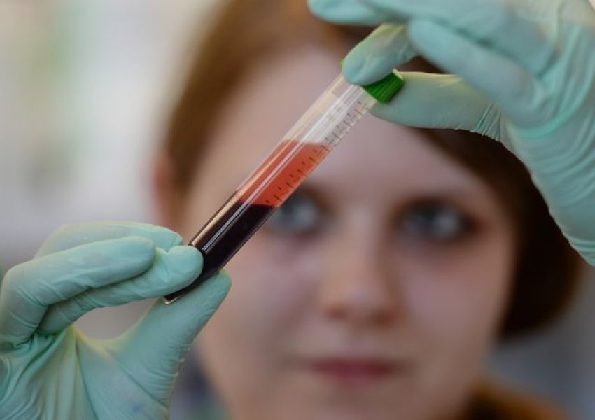 Një test gjaku mund të zbulojë sëmundjet e zemrës dhe veshkave më herët se kurrë